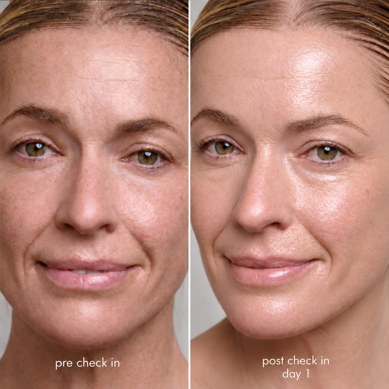 correct_day_1_before_and_after.jpg